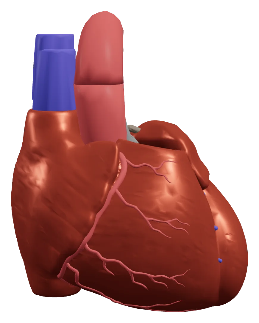Corazón en 3D con las arterias coronarias